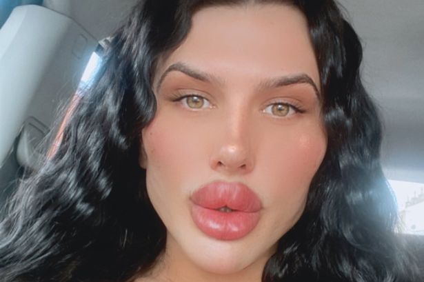 'I spent £50,000 on the UK's biggest lips - haters call me a monster but I won't stop'