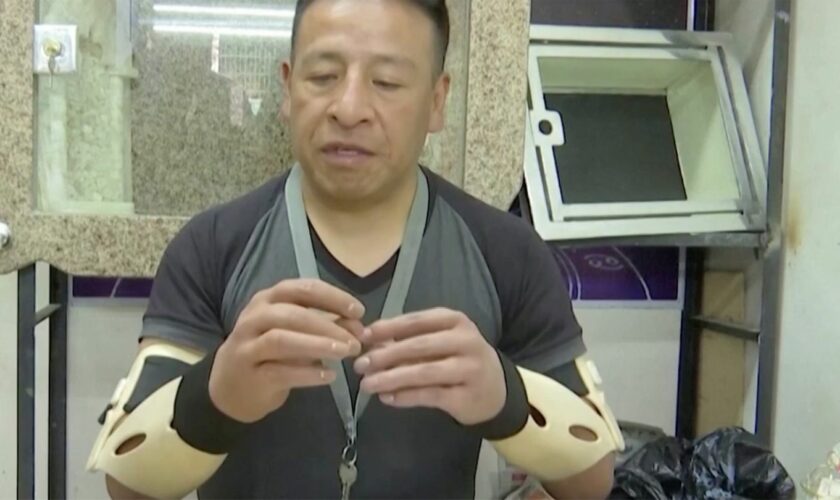 Opfer von Explosion: "Als ich aufwachte, waren meine Hände weg" – Hersteller hilft mit hyperrealistischer Prothese