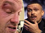 Tyson Fury's heavyweight unification bout against Oleksandr Usyk has been POSTPONED and will NOT take place on February 17, as Gypsy King suffers a severe cut in sparring 'which needed 15 stitches'