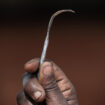 L'Unicef déplore plus de 230 millions de survivantes de mutilations génitales dans le monde