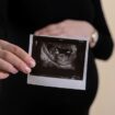 Des chercheurs cultivent des mini-organes pour diagnostiquer les maladies des fœtus
