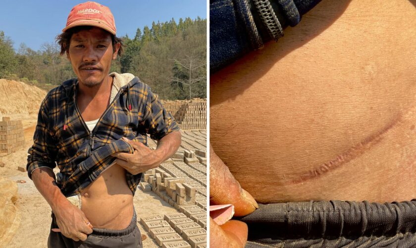 Villagers duped into selling kidneys and told organ would regrow