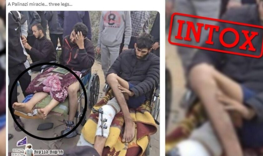 L'image d'un blessé à trois jambes à Gaza générée par l'IA ? Comment un vrai cliché a été détourné