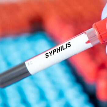 Aux Etats-Unis comme en France, le nombre de cas de syphilis augmente.