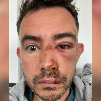 « J’ai été victime d’une agression homophobe » : à Lyon, deux hommes portent plainte après avoir été frappés en pleine rue