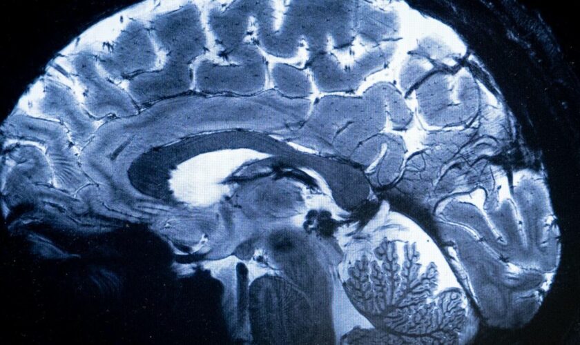 L’IRM le plus puissant du monde dévoile ses premières images de cerveau humain