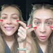 Woman shares why she regrets getting under eye filler