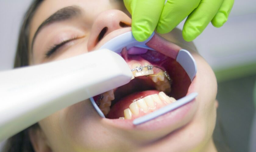 À quelle fréquence faut-il consulter un dentiste?
