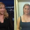 Amy Schumer gets candid about her 'puffy face' caused by hormonal disorder Cushing's syndrome