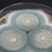 Pilze als Krankmacher: Manche befallen die Lunge, andere zerfressen das Gehirn