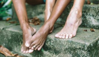 Qu'est-ce que la podophobie, cette peur intense des pieds?