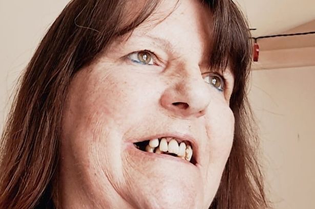 Woman pulls out own tooth with pliers after calling 100 dentists and not getting appointment
