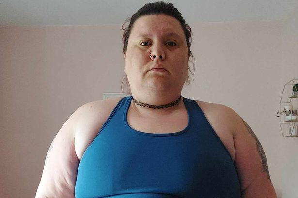 Woman who cried in pain when walking down street loses 12st after weight loss surgery