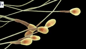 Der Mythos der sinkenden Spermienqualität