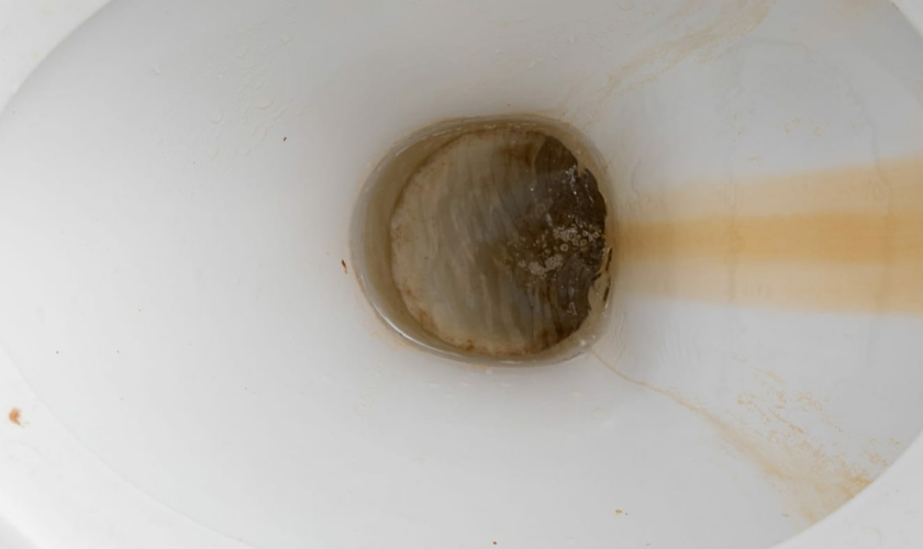 Un expert explique comment éliminer les traces brunes et le calcaire dans les toilettes