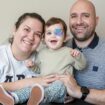 Toddler who had eye removed due to rare cancer gets new prosthetic design