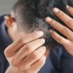 Des scientifiques ont peut-être trouvé le remède miracle contre la perte de cheveux