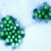 Highly contagious norovirus stomach bug hits Italian village
