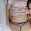 Kaiserschnitte: Welche Folgen haben sie für die Mütter?