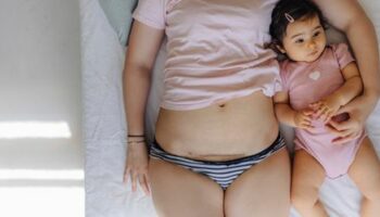 Kaiserschnitte: Welche Folgen haben sie für die Mütter?