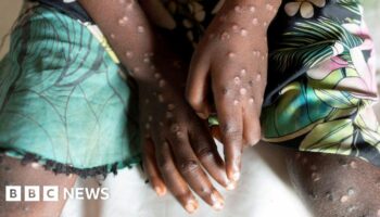 Mpox declared public health emergency in Africa