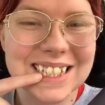 Woman shows off £5,800 teeth transformation after family told her 'don't smile'