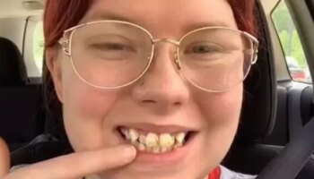 Woman shows off £5,800 teeth transformation after family told her 'don't smile'