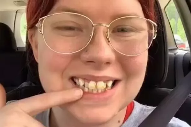 Woman shows off £5,800 teeth transformation after family told her 'don't smile'