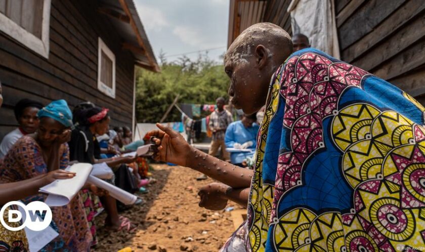 Congo: Displaced people caught between conflict and crisis