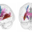 Scans show changes in brain during pregnancy