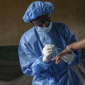 Mpox: Mehr als 800 Tote durch Mpox-Virus in Afrika seit Januar