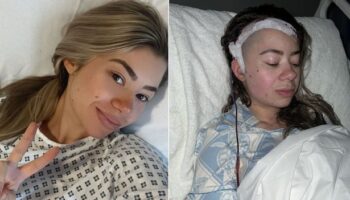 ‘I went blind after doctors dismissed failing sight as migraines – then they found a brain tumour’