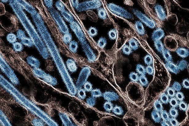 Bird flu kills first human in US after patient developed horror symptoms